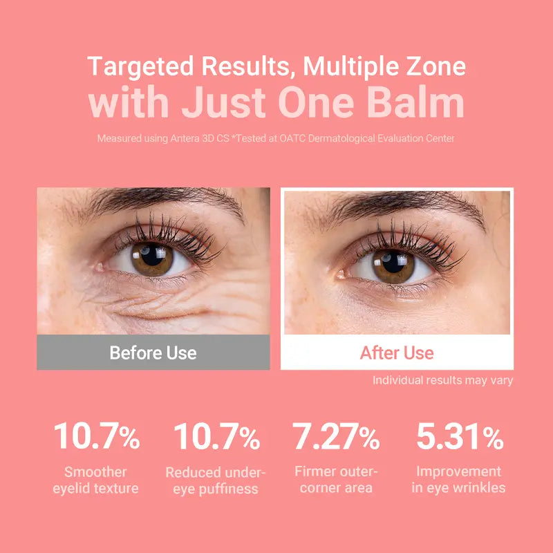 Wrinkle Bounce Balm ✨ Multi-Use Collagen Stick for Face, Lips & Neck 💖 Hydrating, Anti-Aging & Glow-Boosting 🌸