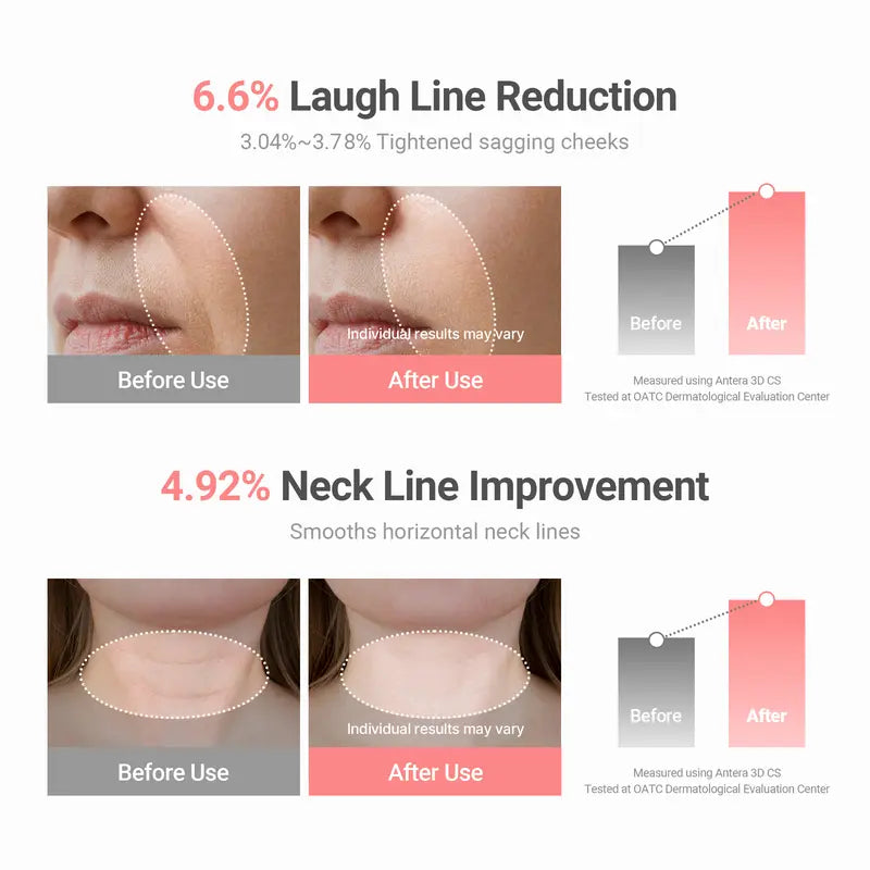 Wrinkle Bounce Balm ✨ Multi-Use Collagen Stick for Face, Lips & Neck 💖 Hydrating, Anti-Aging & Glow-Boosting 🌸