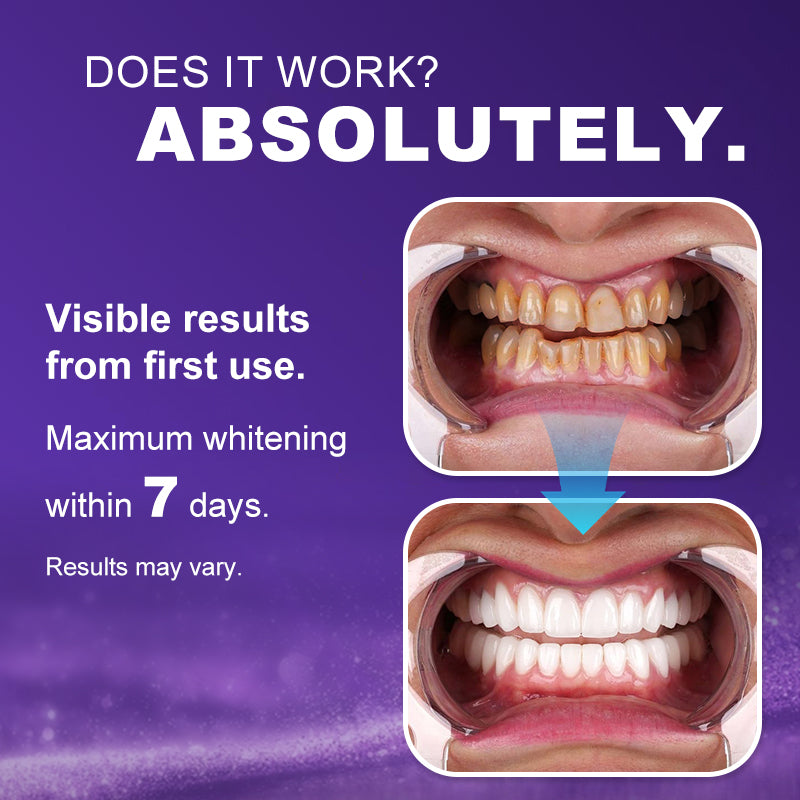 Leafora Purple Teeth Whitening Strips - 7/21 Whitening Sessions - Safe for Enamel - Non Sensitive Teeth Whitening - Peroxide-Free